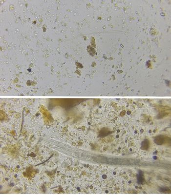 Soil samples highlight the clear differences between an agricultural soil with limited biology (Image 1 above), and a sample of Johnson-Su compost extract, with far more biology present (Image 2 below).